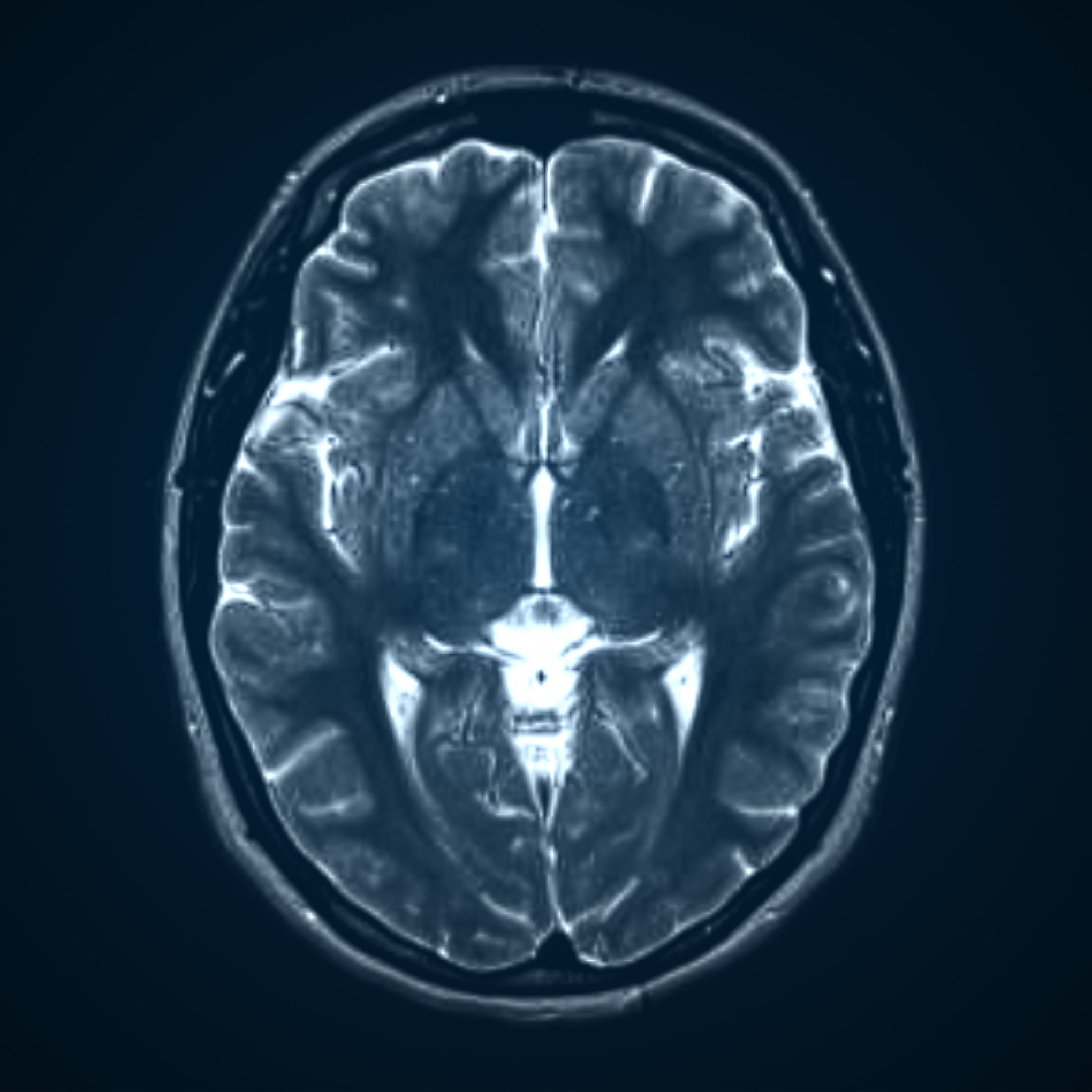 fMRI vs. SPECT Scan for the Brain
